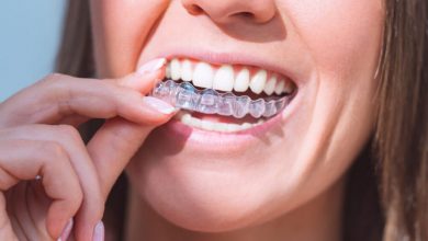 how-do-clear-aligners-work-to-straighten-teeth?